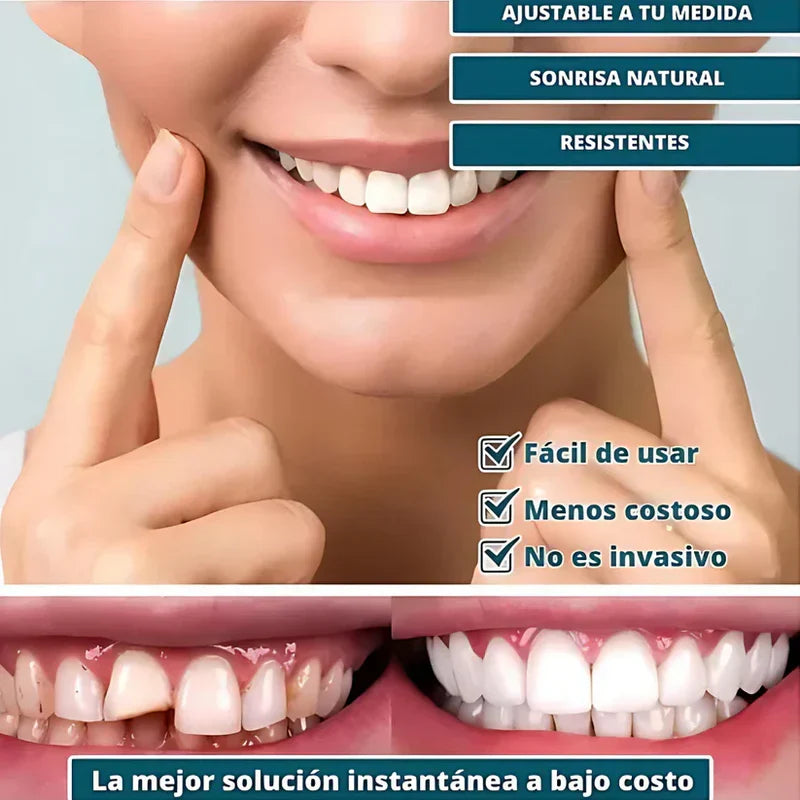 🦷 SmilePro – Carillas Dentales Ajustables + Estuche de Regalo