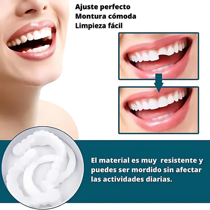 🦷 SmilePro – Carillas Dentales Ajustables + Estuche de Regalo
