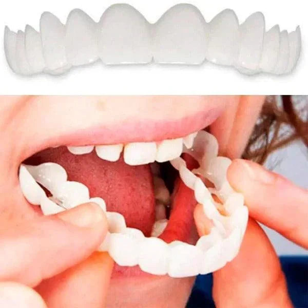 🦷 SmilePro – Carillas Dentales Ajustables + Estuche de Regalo